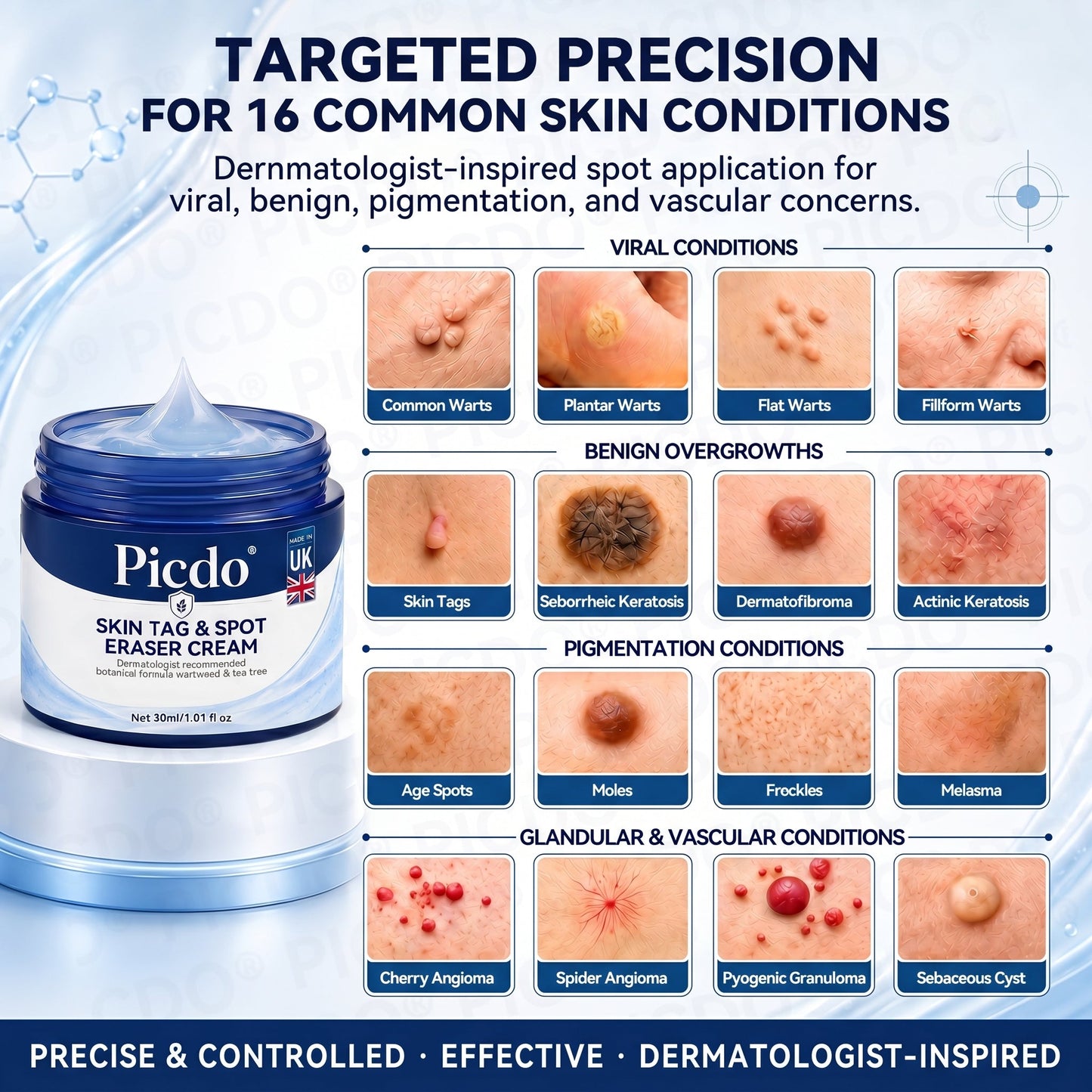 🍀𝐏𝐢𝐜𝐝𝐨® 7-𝐃𝐚𝐲 𝐒𝐤𝐢𝐧 𝐓𝐚𝐠 & 𝐒𝐩𝐨𝐭 𝐄𝐫𝐚𝐬𝐞𝐫 𝐂𝐫𝐞𝐚𝐦 (Zero Pain, Zero 𝐒𝐜𝐚𝐫𝐬 Formula) 💯