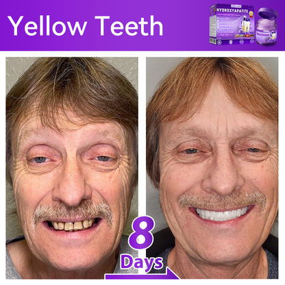 🏍️😁New Year Special: 80% OFF🎉 Dormorna® Hydroxyapatite Tooth Restorative Powder 🦷