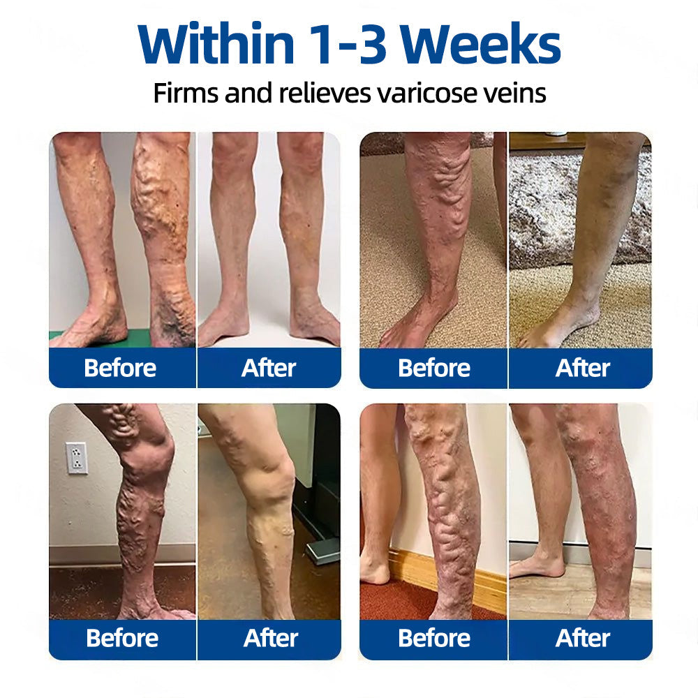 ✨👍𝐅𝐥𝐨𝐫𝐢𝐬𝐦𝐚® 𝐕𝐞𝐢𝐧𝐓𝐚𝐫𝐠𝐞𝐭 𝐌𝐢𝐜𝐫𝐨𝐧𝐞𝐞𝐝𝐥𝐞 𝐏𝐚𝐭𝐜𝐡⚡ —An advanced blend of plant-based ingredients to help target spider veins and varicose veins, while relieving heavy, tired legs.