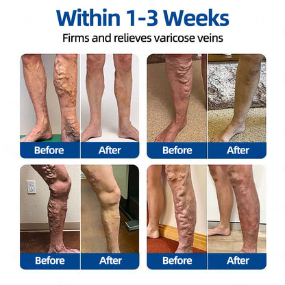 ✨👍𝐅𝐥𝐨𝐫𝐢𝐬𝐦𝐚® 𝐕𝐞𝐢𝐧𝐓𝐚𝐫𝐠𝐞𝐭 𝐌𝐢𝐜𝐫𝐨𝐧𝐞𝐞𝐝𝐥𝐞 𝐏𝐚𝐭𝐜𝐡⚡ —An advanced blend of plant-based ingredients to help target spider veins and varicose veins, while relieving heavy, tired legs.