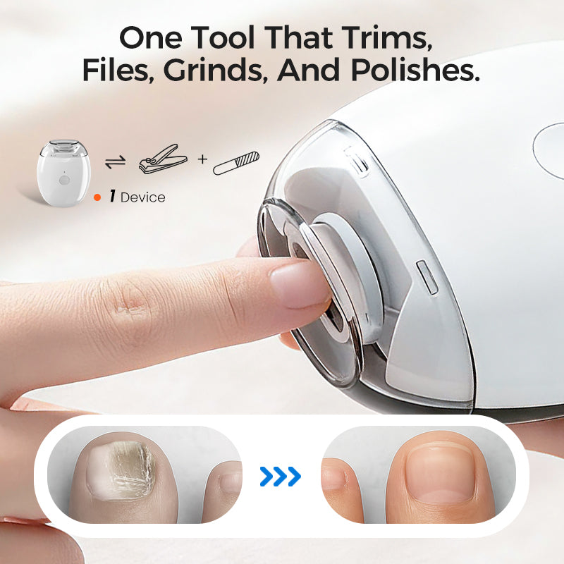 💐New Year Special: 50% Off ✨ Multifunction Automatic Nail Trimmer – 6 Speed Levels, Safe and Gentle for Easy Nail Care 💅