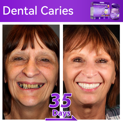 🏍️😁New Year Special: 80% OFF🎉 Dormorna® Hydroxyapatite Tooth Restorative Powder 🦷