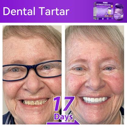 🏍️😁New Year Special: 80% OFF🎉 Dormorna® Hydroxyapatite Tooth Restorative Powder 🦷