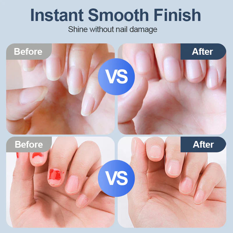 🌏🌏Universal Automatic Fingernail Grinder - 6 Speed Settings with 5 Attachments for Safe & Gentle Nail Care 💅✨